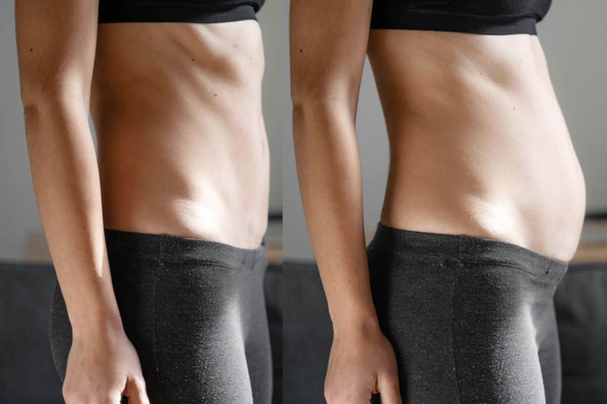 How long does diastasis recti take to improve Keighley?