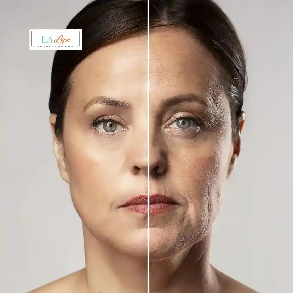 How Can You Tell If Non-Surgical Skin Tightening Is Right for You Keighley?