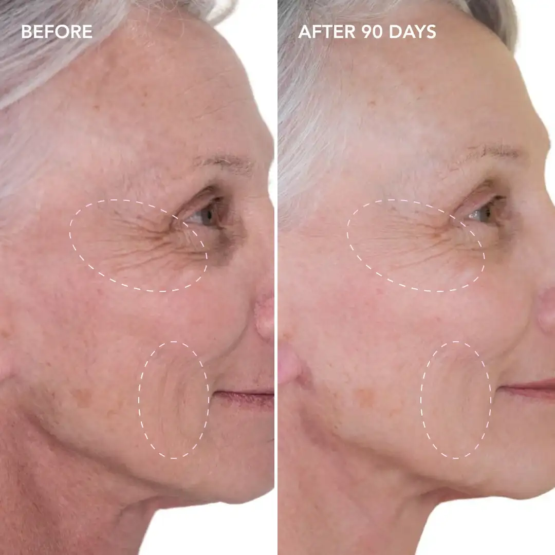 When will you see results Keighley